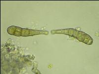 Alternaria Sporen 2