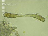 Alternaria Sporen 2